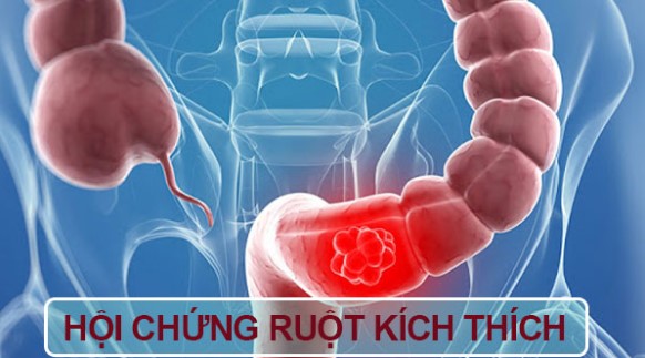 đau bụng dưới ở nam