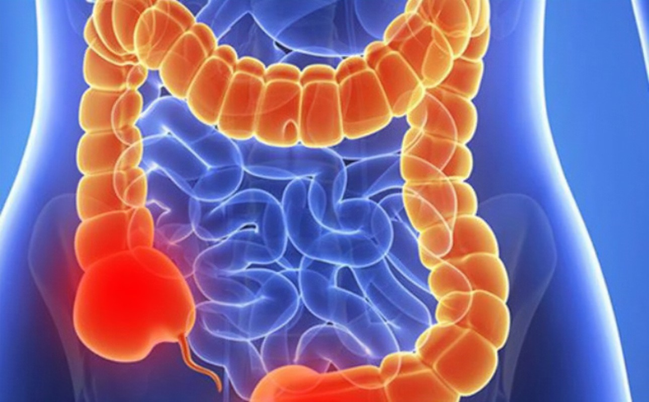 đau bụng râm ran