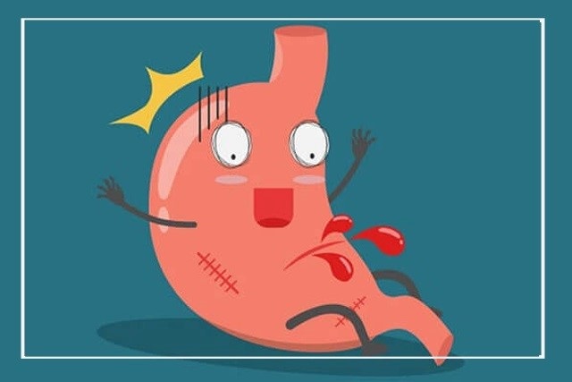 đau dạ dày là đau ở đâu