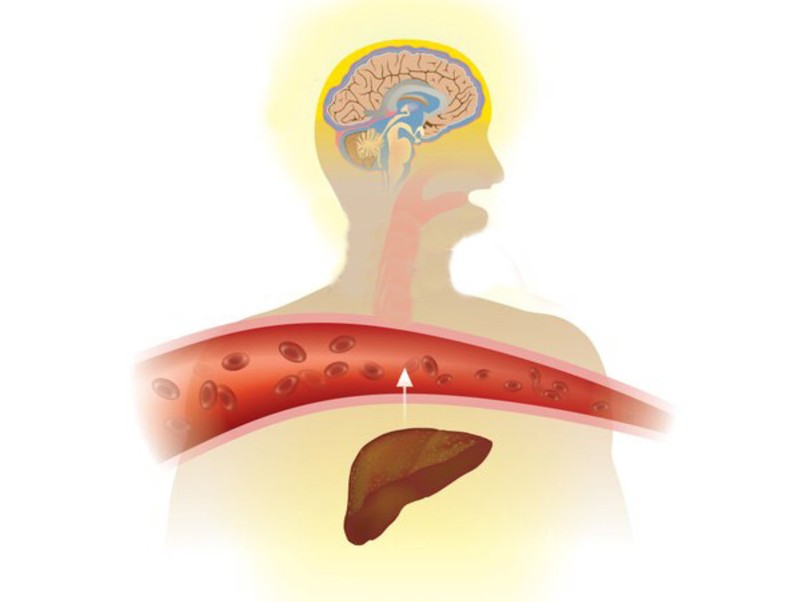 dấu hiệu của bệnh gan