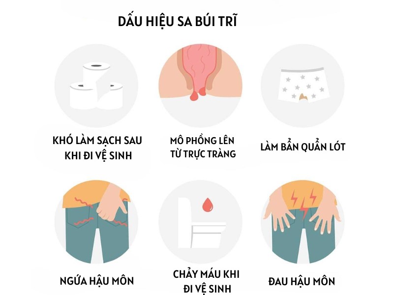 Dấu hiệu sa búi trĩ