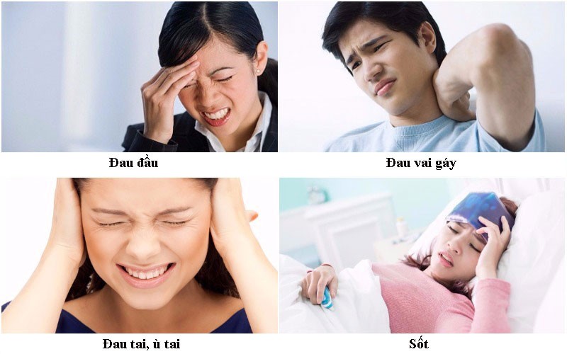 những dấu hiệu của bệnh viêm xoang