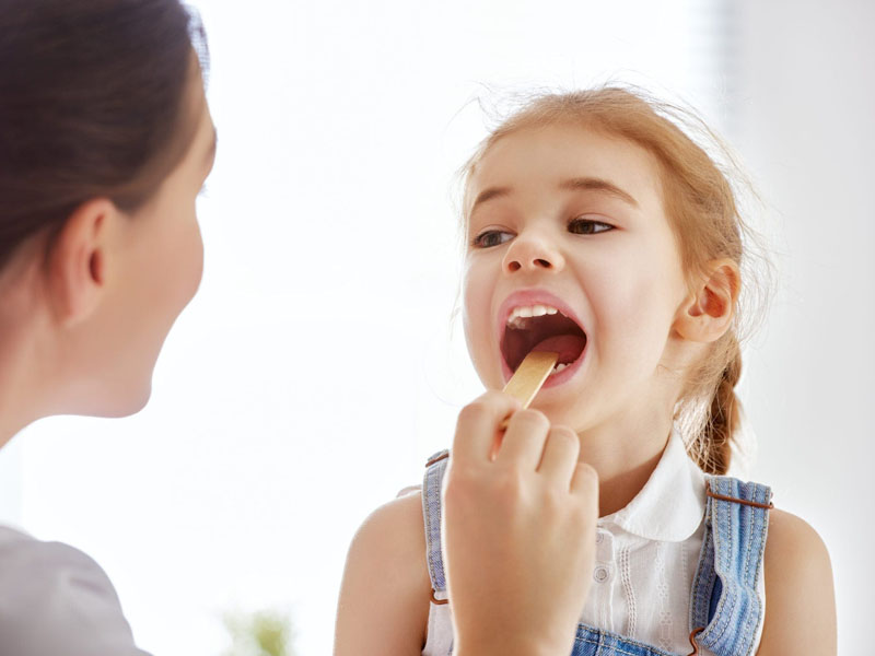 đau họng có đờm