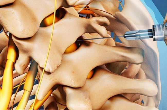 đau lưng là dấu hiệu bệnh gì