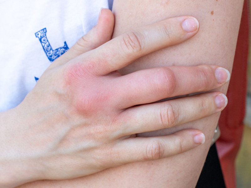 Đau khớp ngón tay giữa 