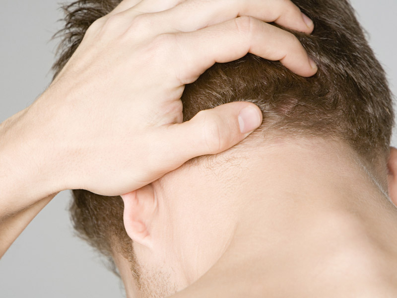 đau nửa đầu sau gáy