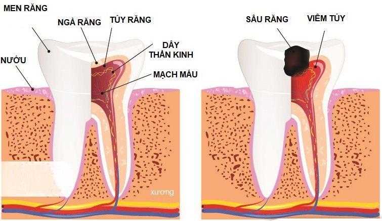 đau răng uống thuốc gì