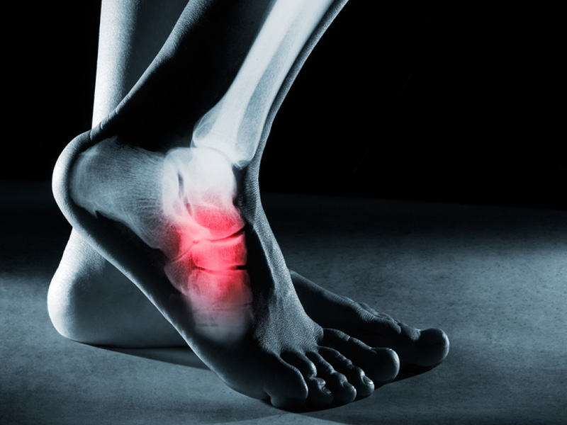 đau nhức xương bàn chân