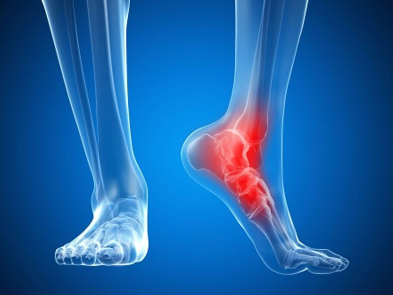 đau nhức xương bàn chân