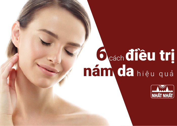 điều trị nám da