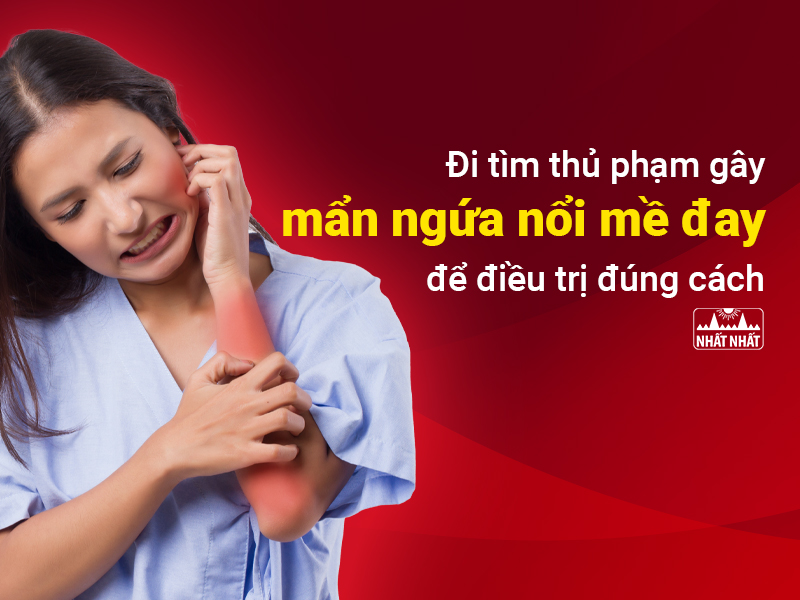 Mẩn ngứa nổi mề đay do rất nhiều nguyên nhân gây ra
