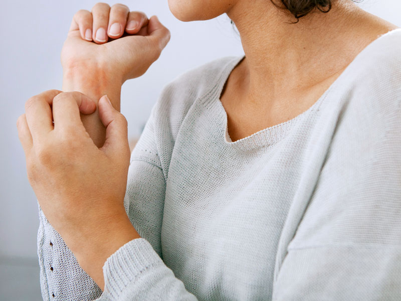 Dị ứng nổi mề đay 