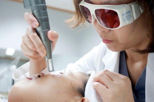 điều trị nám da