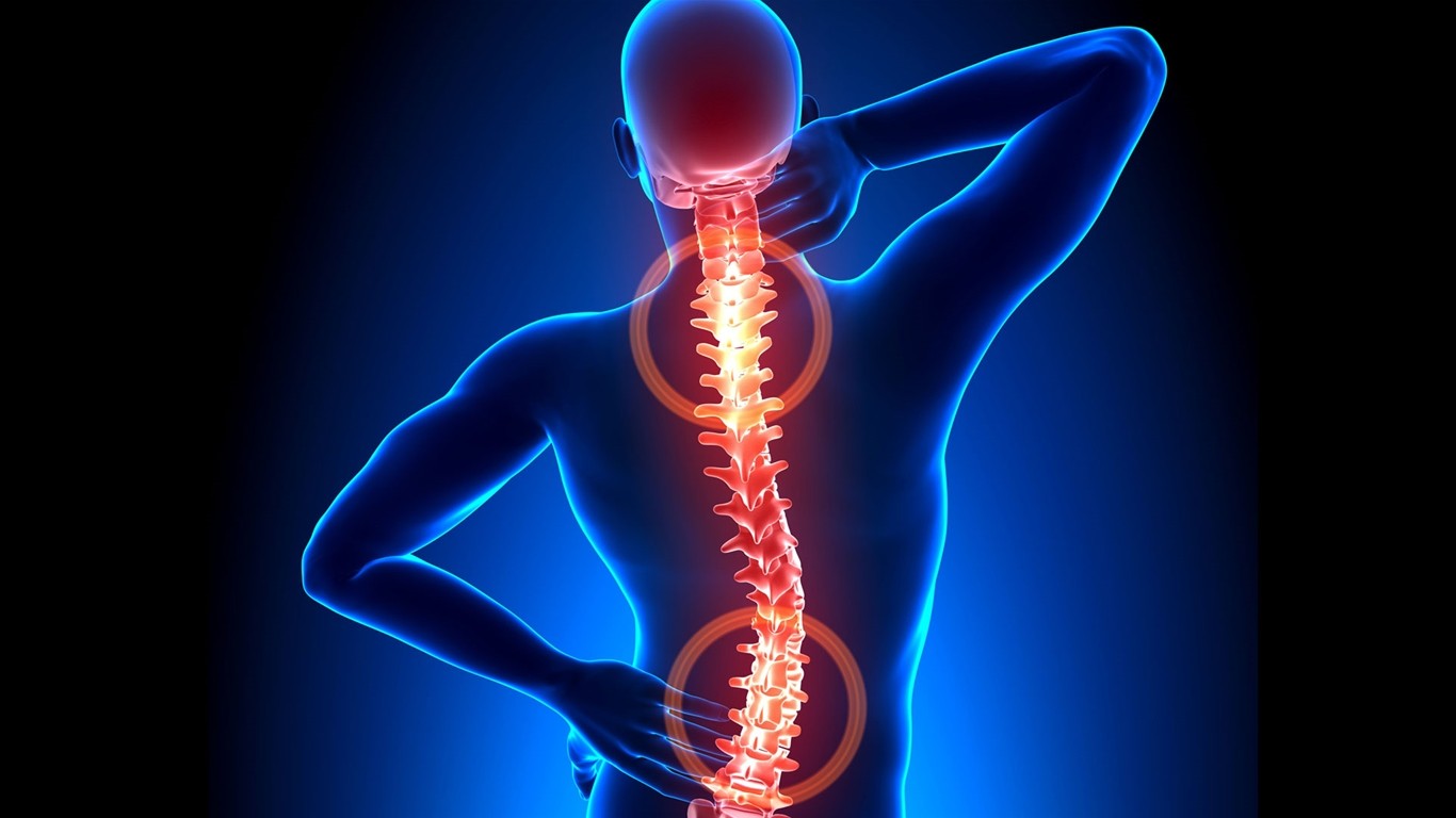 bệnh gai cột sống