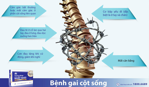 bệnh gai cột sống