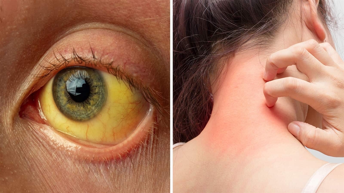 nhận biết gan nhiễm độc