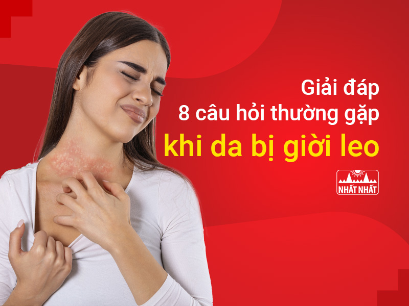 Da bị giời leo gây đau đớn và khó chịu cho người mắc bệnh