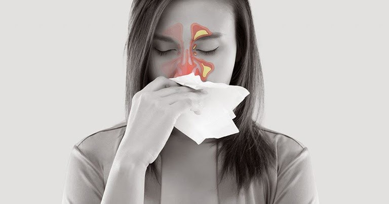 hắt xì sổ mũi liên tục