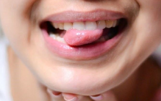 Hệ miễn dịch suy giảm gây lở miệng, nhiệt lưỡi