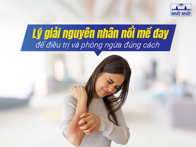 Hiểu nguyên nhân giúp phòng tránh và xử lí mề đay hiệu quả hơn