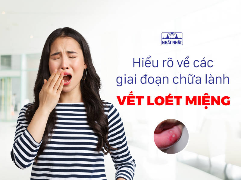 Tìm hiểu cách chữa lành vết loét miệng