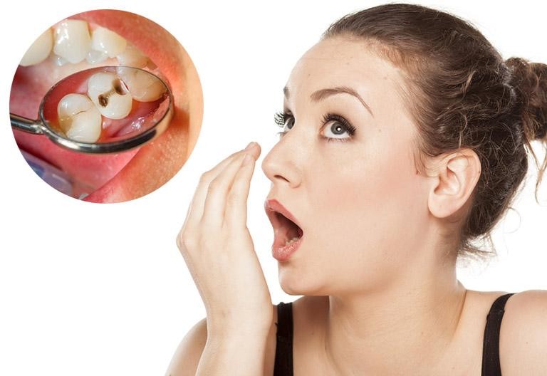 hôi miệng là biểu hiện của bệnh gì