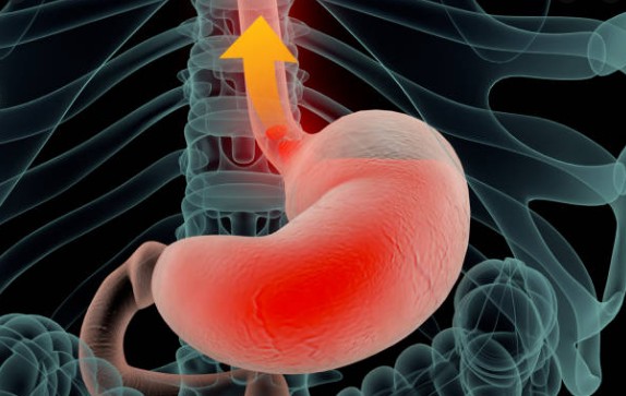 hôi miệng là biểu hiện của bệnh gì