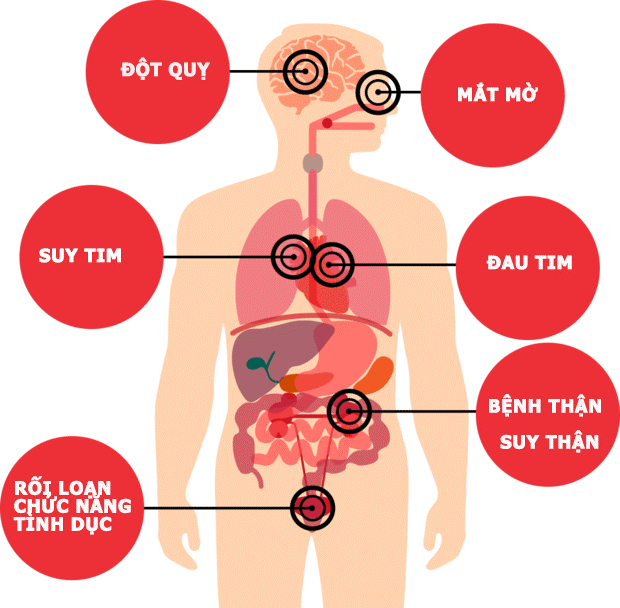 người huyết áp cao