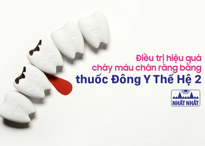 chảy máu chân răng nhiều