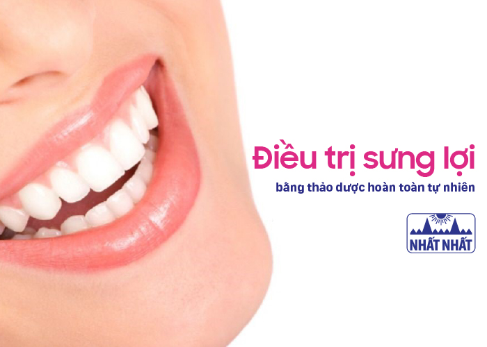 điều trị sưng lợi