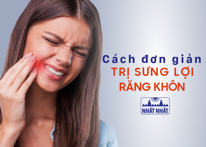 sưng lợi mọc răng khôn
