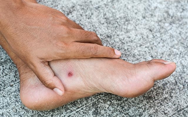 kẽm có tác dụng gì