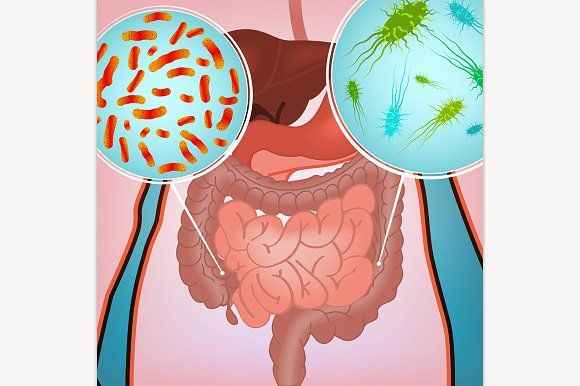 Loạn khuẩn đường ruột là một trong những nguyên nhân gây táo bón