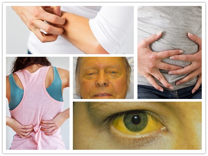 dấu hiệu men gan cao