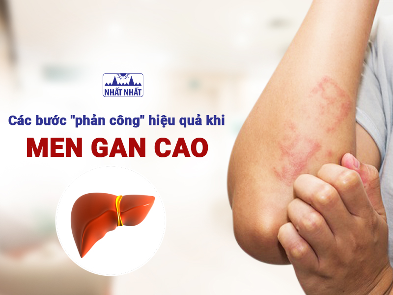 Men gan cao cần được điều trị sớm