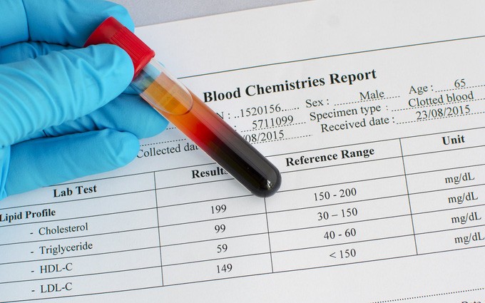 người bị mỡ máu cao