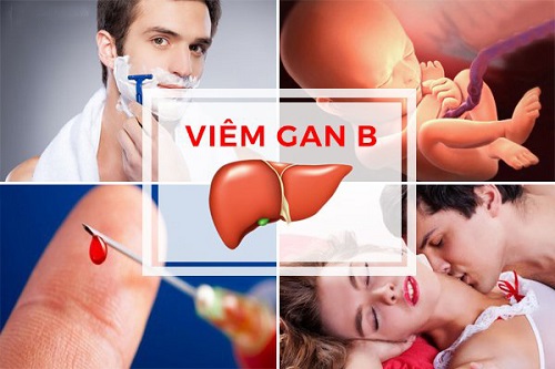 Một số con đường lây truyền viêm gan B