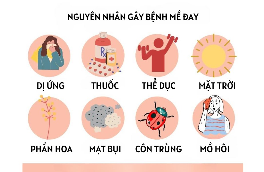 Một số nguyên nhân gây bệnh mề đay