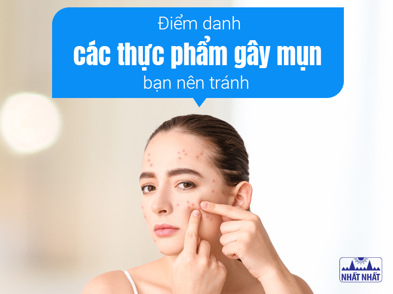 Mụn là vấn đề về da mà nhiều người gặp phải