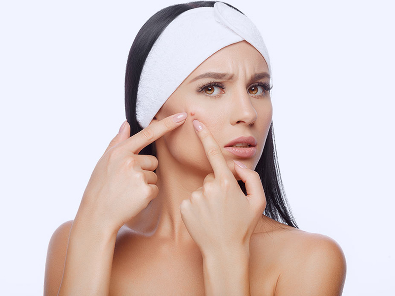 mụn trứng cá khi mang thai