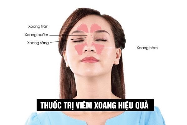 thường xuyên bị ngạt mũi