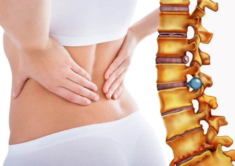 ngồi lâu bị đau lưng