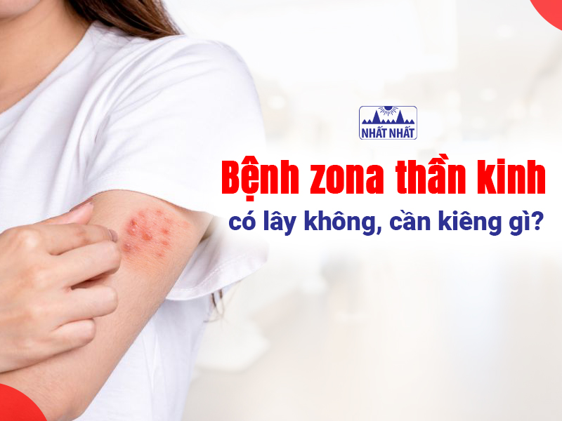 Nguyên nhân gây bệnh zona thần kinh là virus varicella zoster