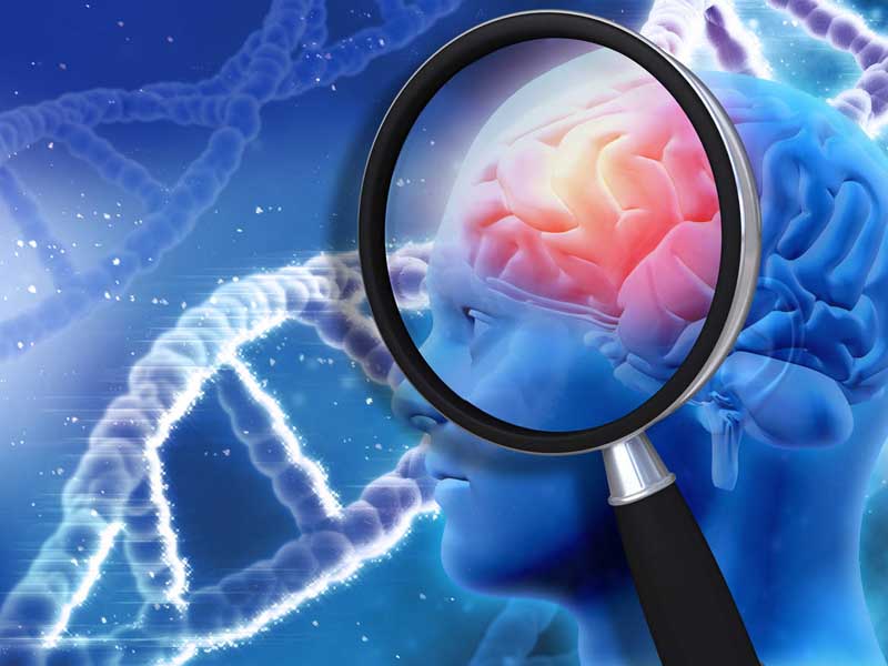 nguyên nhân gây tai biến mạch máu não