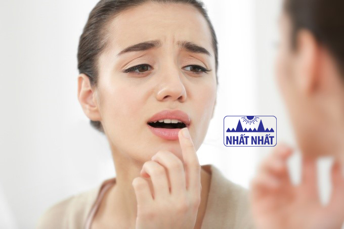 nhiệt lưỡi uống thuốc gì