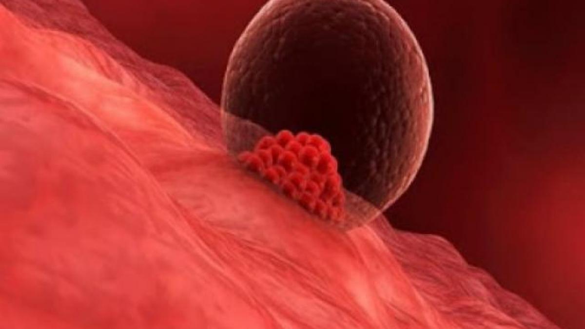 Phôi “làm tổ” trong tử cung có thể gây đau bụng và chảy máu nhẹ