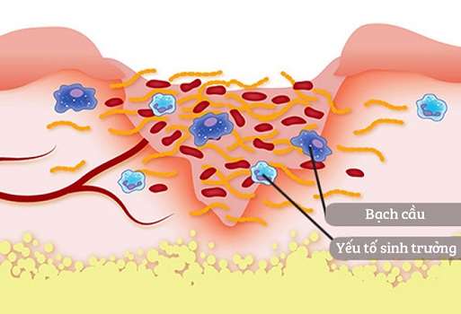 Quá trình làm sạch vết thương của các tế bào bạch cầu