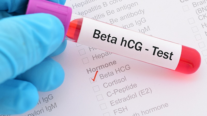 que thử thai 2 vạch mờ