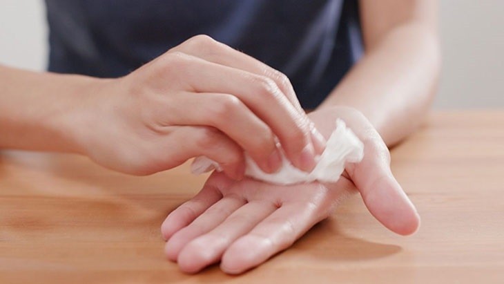 Ra mồ hôi chân tay là bệnh gì