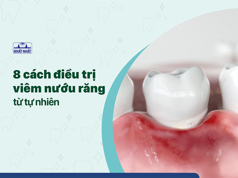 điều trị viêm nướu răng
